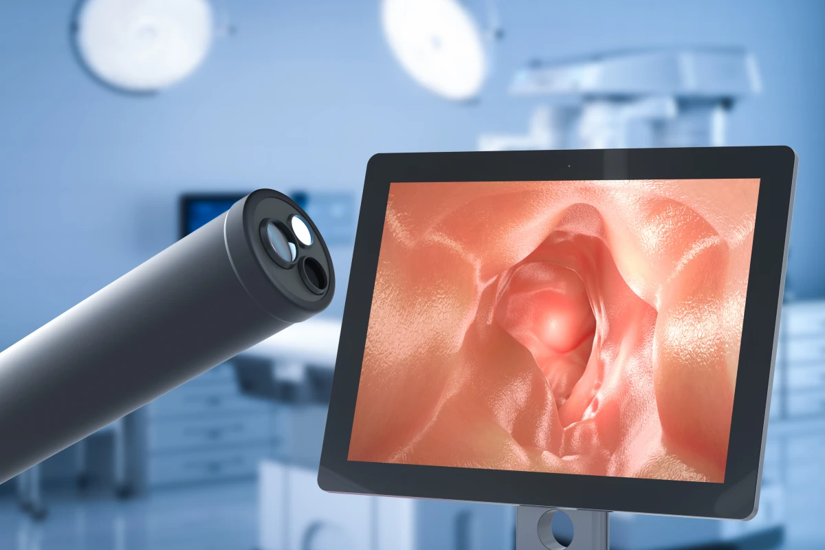 IDS case study endoscope